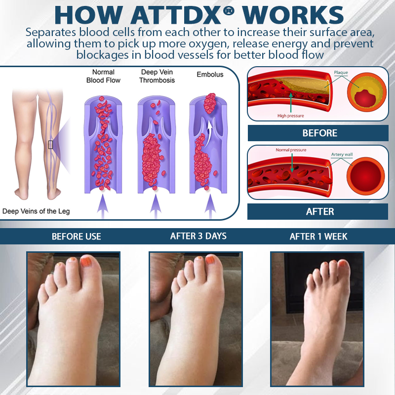 ATTDX® Black Cumin Edema Soothing Herbal Cream 3 -👩⚕️Doctor-Endorsed Herbal Formula