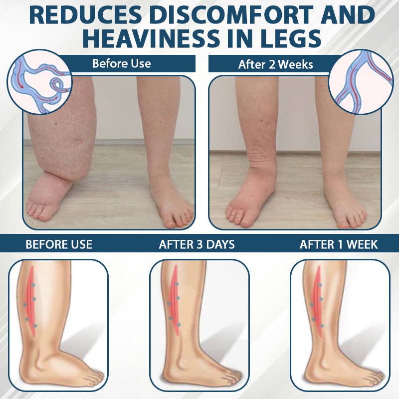 ATTDX® Black Cumin Edema Soothing Herbal Cream 3 -👩⚕️Doctor-Endorsed Herbal Formula