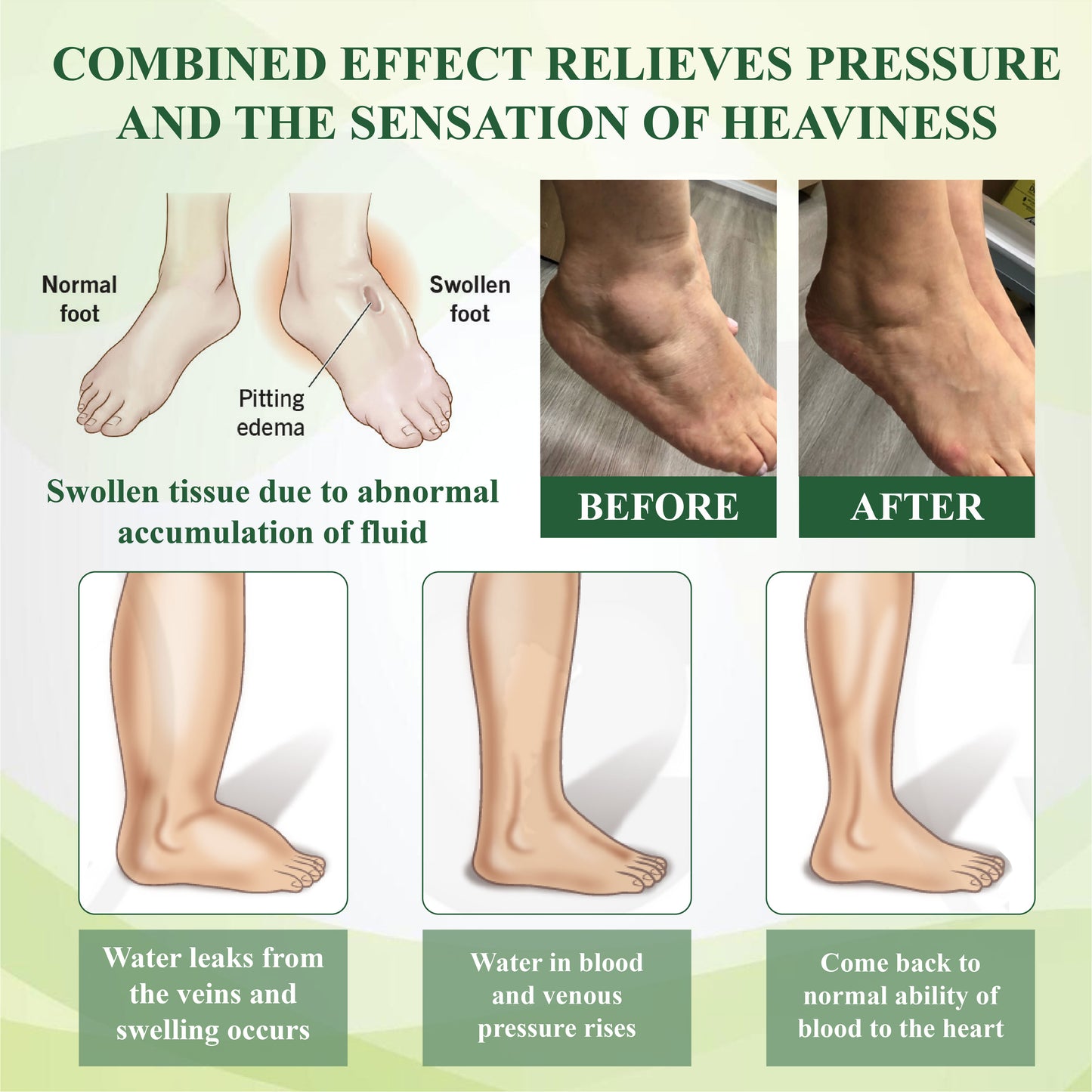 ATTDX® FluidEx Circulation & Drainage Capsules