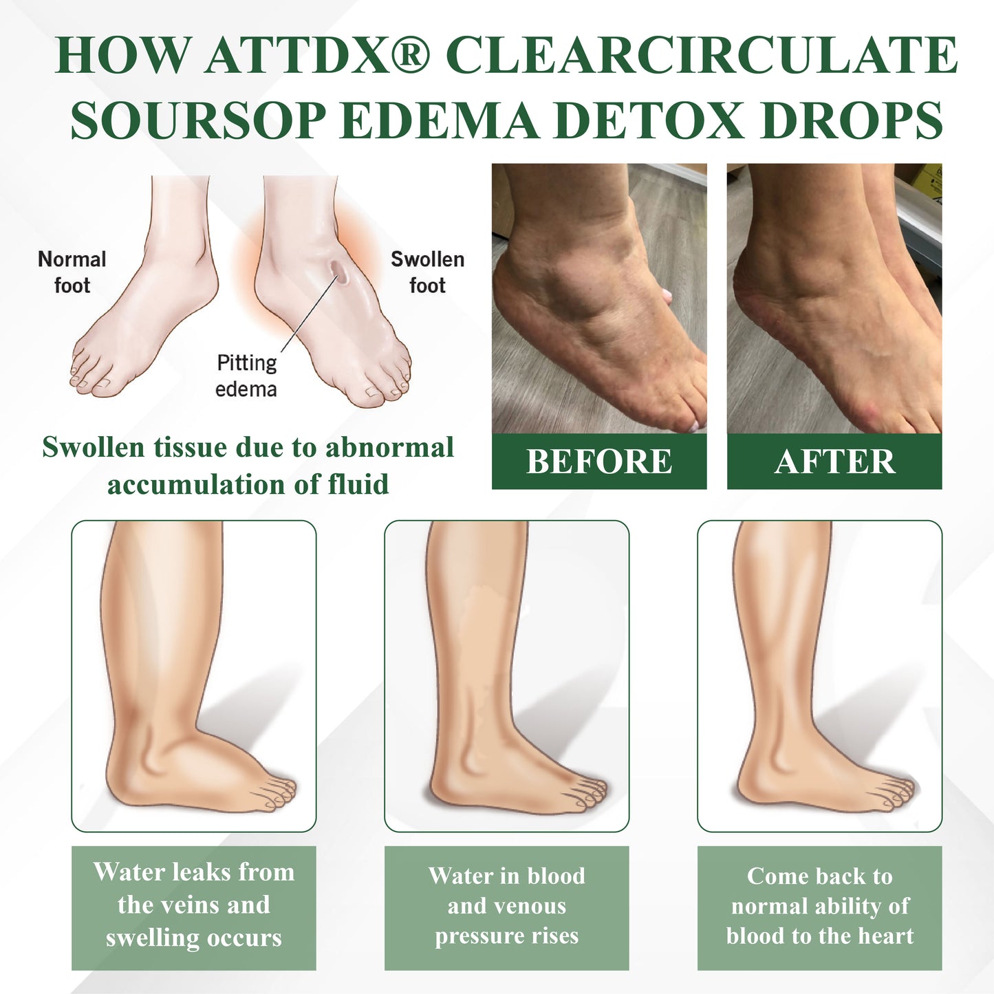 ATTDX® ClearCirculate Soursop Edema Detox Drops