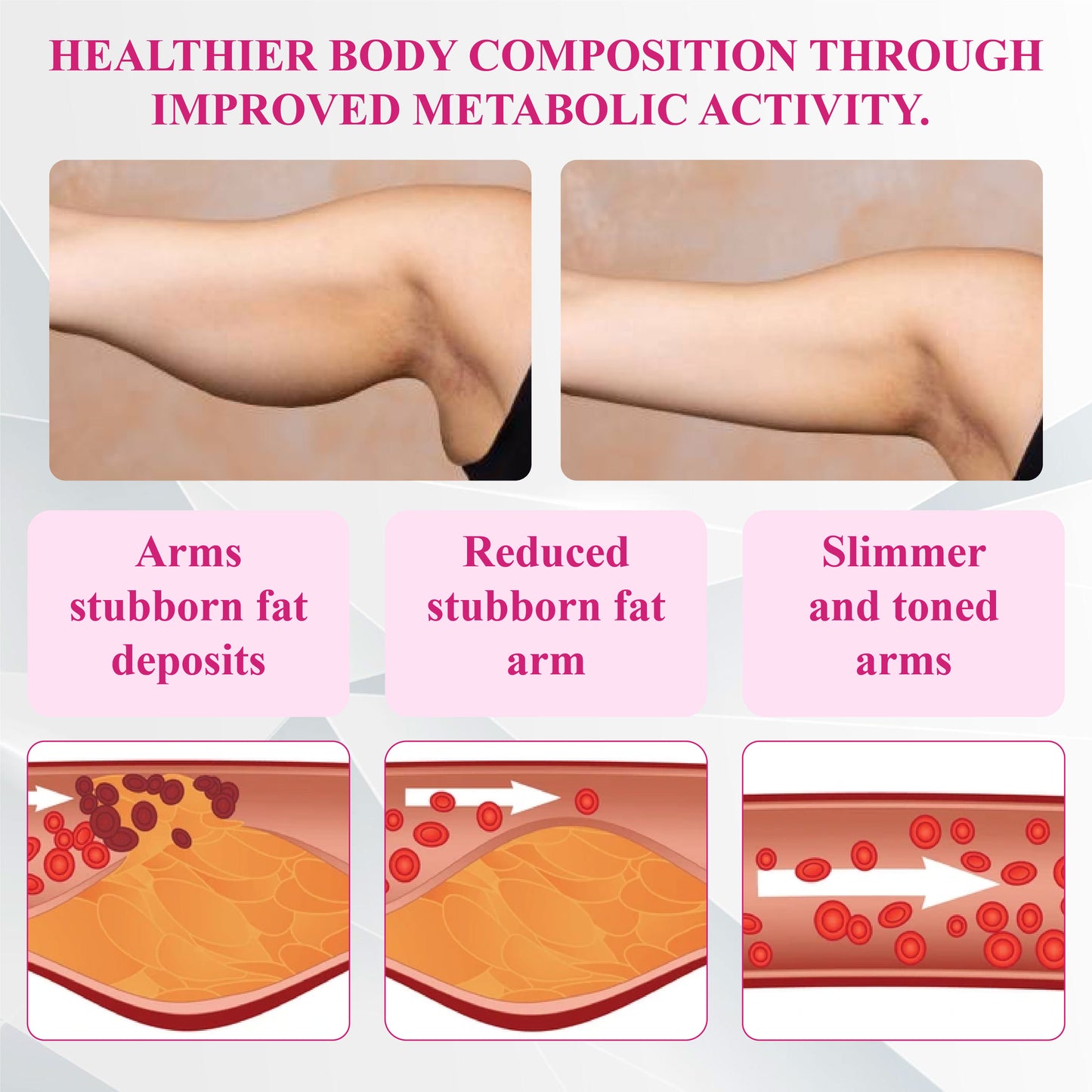 ATTDX® FemmeShape GutSlim Probiotics