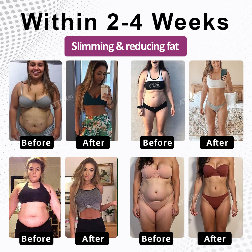 ATTDX® FemmeShape GutSlim Probiotics