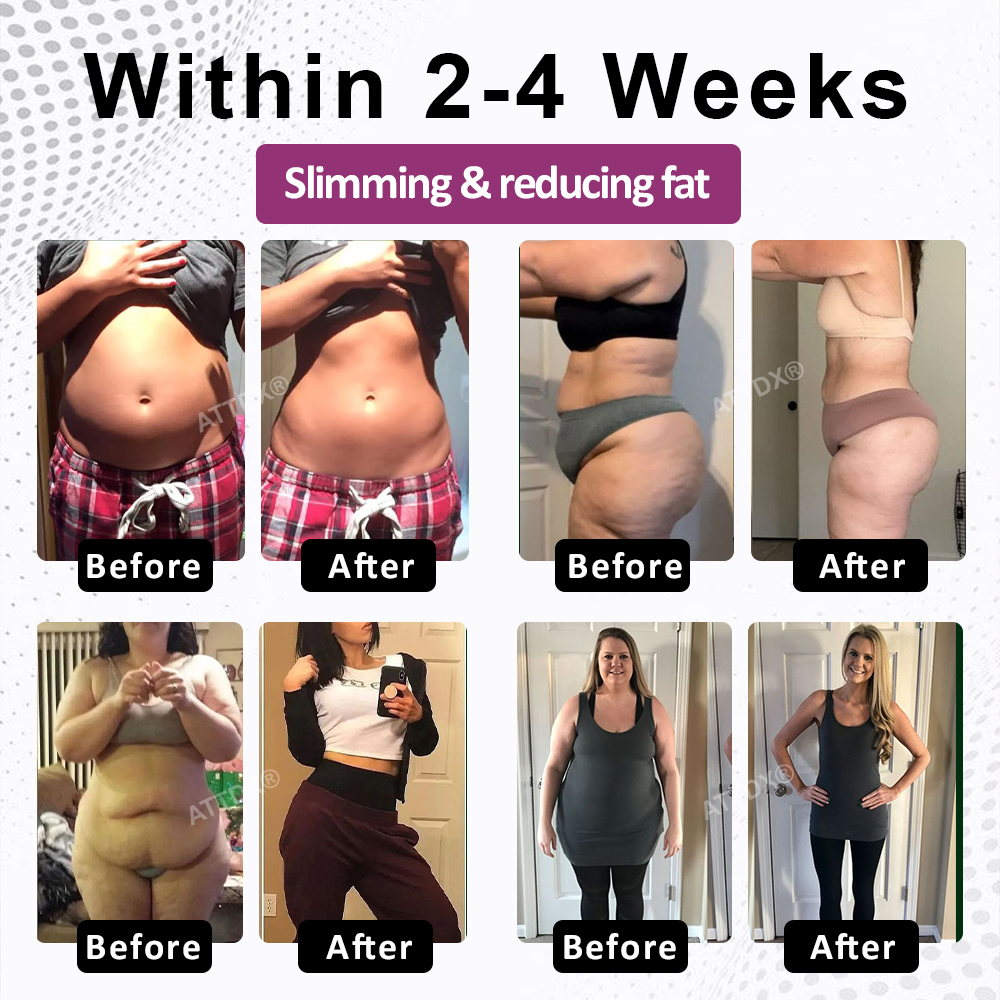 ATTDX® FemmeShape GutSlim Probiotics