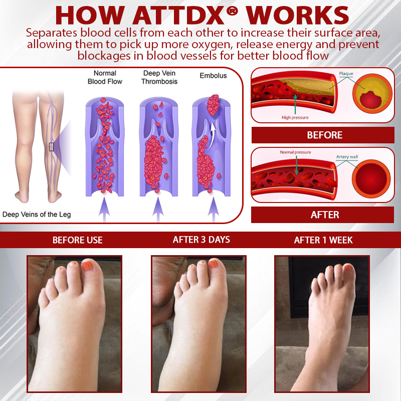 ATTDX® CircuBeet Edema Health Gummies