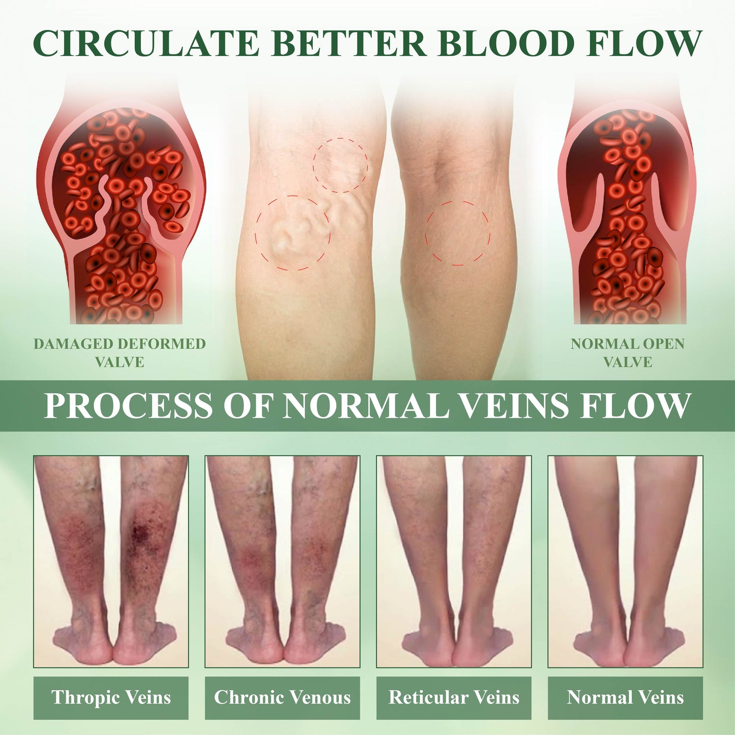 ATTDX® FluidEx Circulation & Drainage Capsules