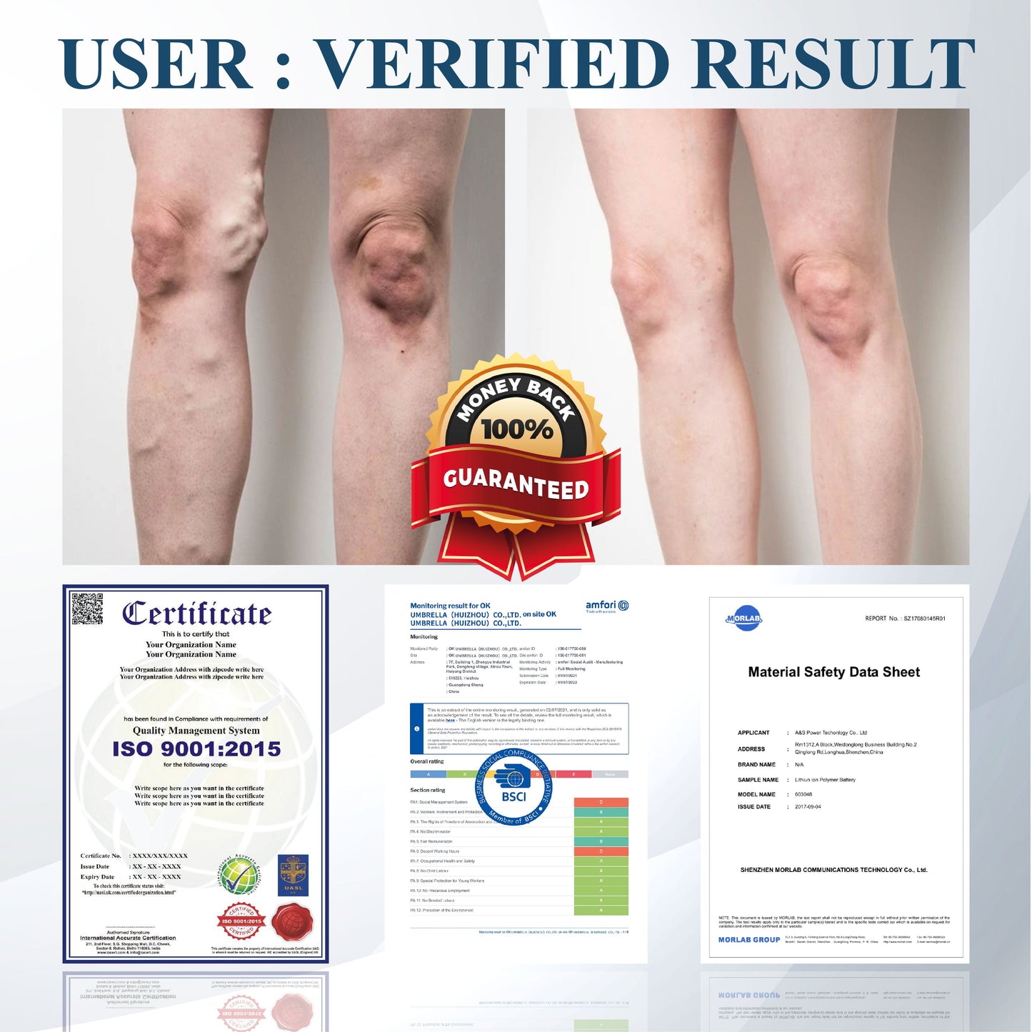 ATTDX® Black Cumin Edema Soothing Herbal Cream 3 -👩‍⚕️Doctor-Endorsed Herbal Formula