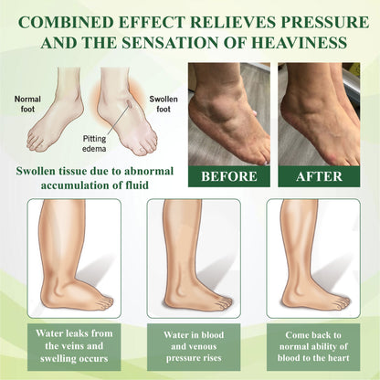 ATTDX® FluidEx Circulation & Drainage Capsules