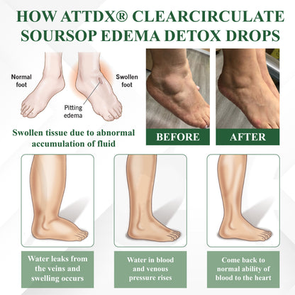 ATTDX® ClearCirculate Soursop Edema Detox Drops