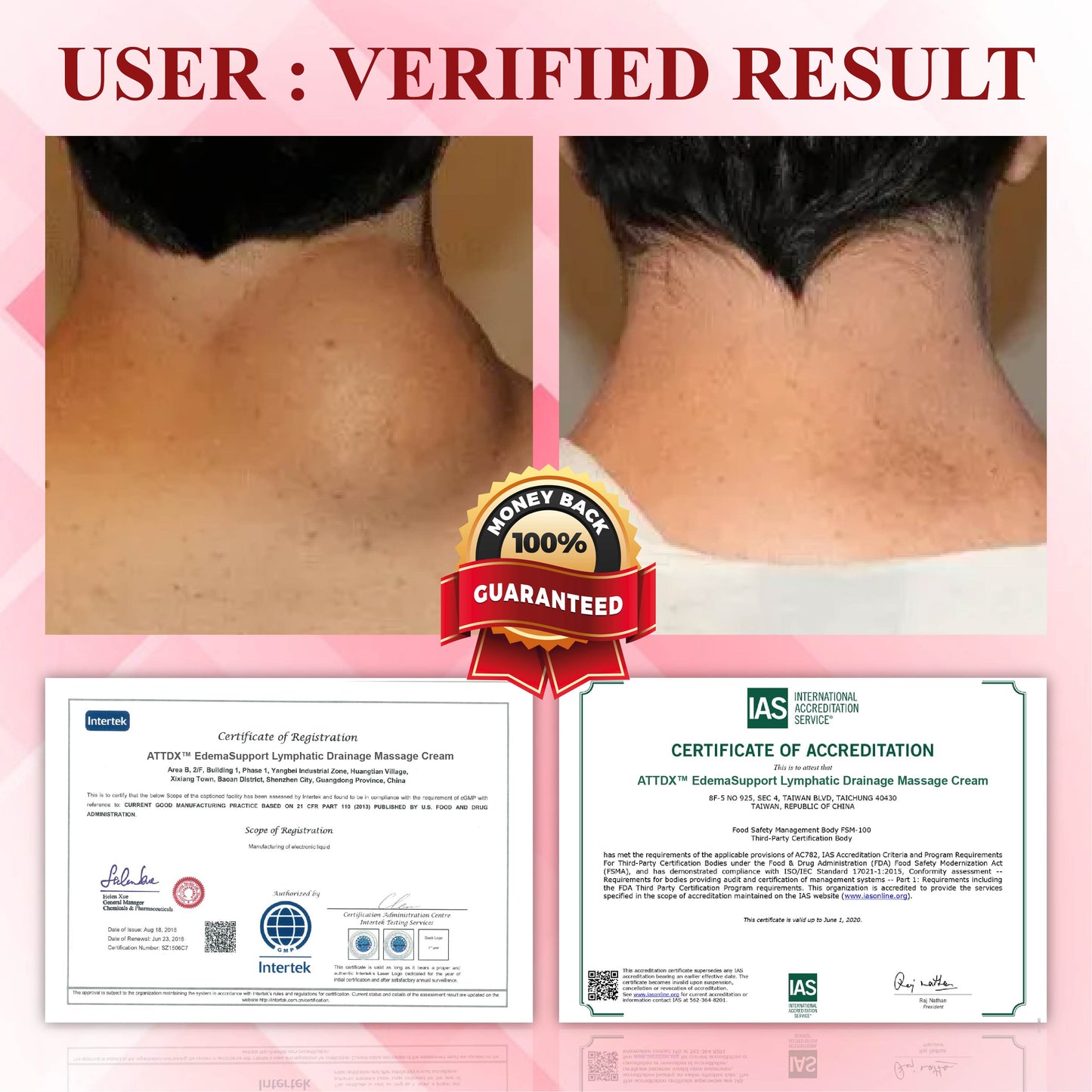 ATTDX® EdemaSupport Lymphatic Drainage Massage Cream 2