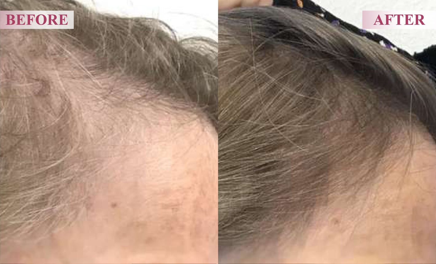 ATTDX Hair Reawaken PP405 Roll On Serum for woman 12