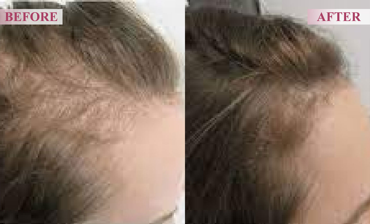 ATTDX Hair Reawaken PP405 Roll On Serum for woman 13