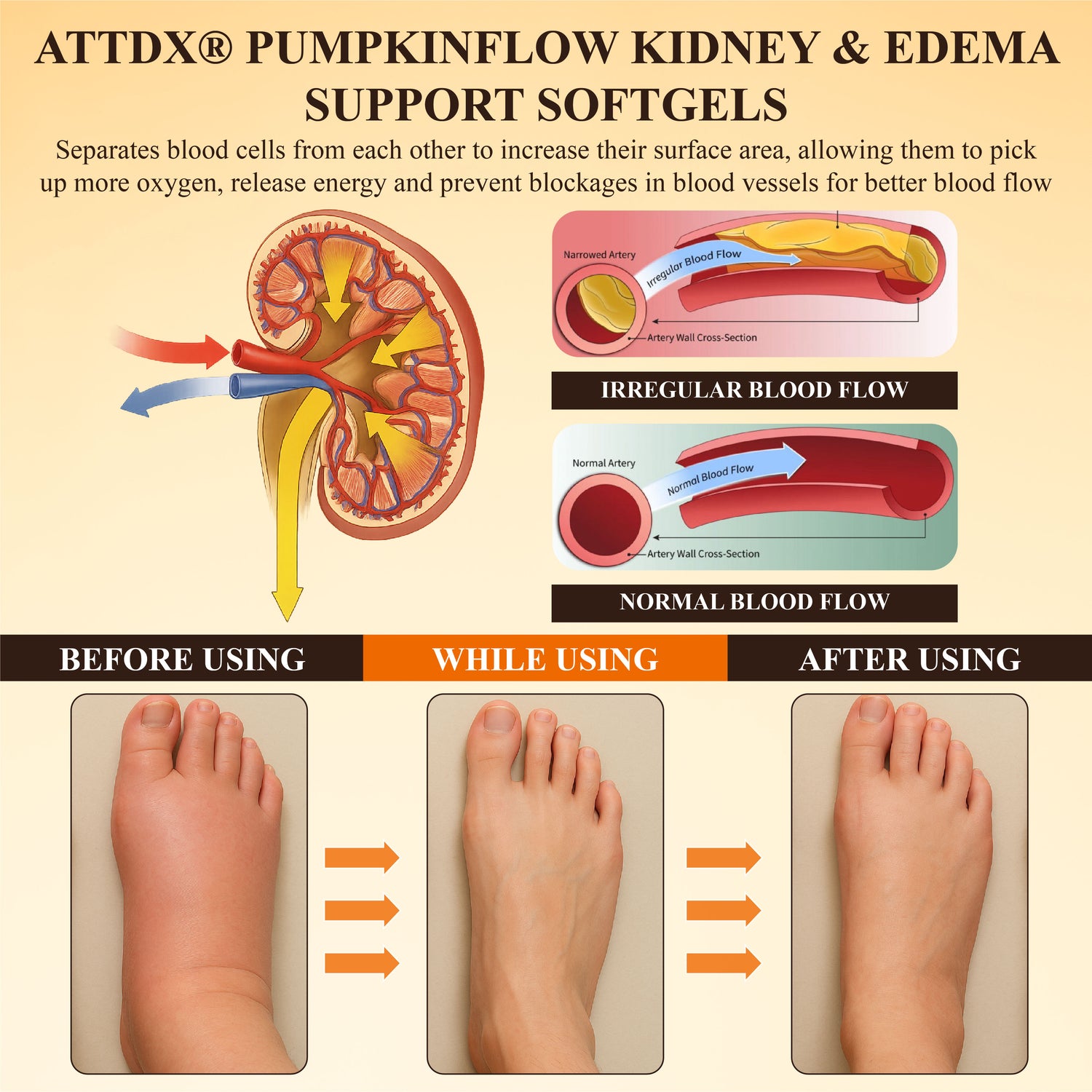 ATTDX® PumpkinFlow Kidney & Edema Support Softgels 29 ATTDX PumpkinFlow Kidney Edema Support Softgels 08